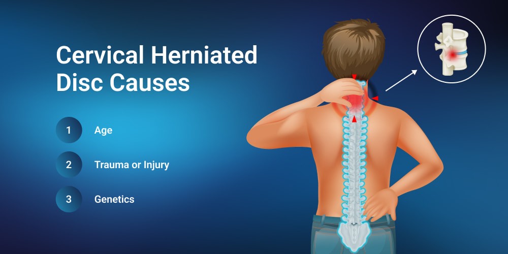 5 Things You Should Know about Herniated Discs in the Neck